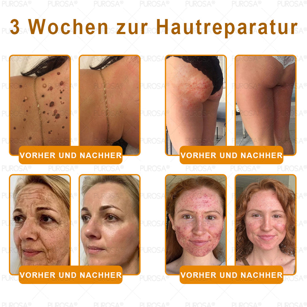 🌿🌿𝗣𝗨𝗥𝗢𝗦𝗔® Eine letzte Chance! Schnappen Sie sich diesen Glücksfund mit 50 % Rabatt!