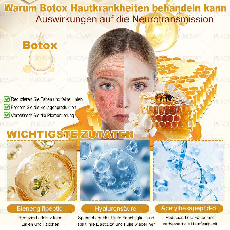 ❤️𝗣𝗨𝗥𝗢𝗦𝗔® 8-in-1 Bienengift & Talg Hautcreme – Jetzt -80% · Sichtbare Wirkung in 7 Tagen · Nur heute letzter Tag!