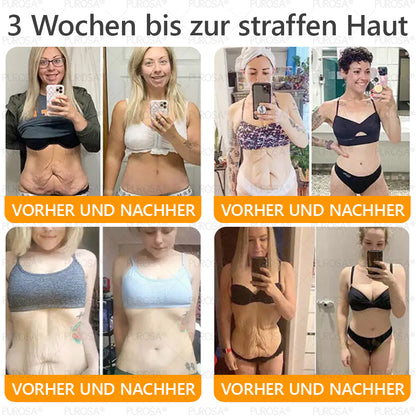 ❤️𝗣𝗨𝗥𝗢𝗦𝗔® 8-in-1 Bienengift & Talg Hautcreme – Jetzt -80% · Sichtbare Wirkung in 7 Tagen · Nur heute letzter Tag!
