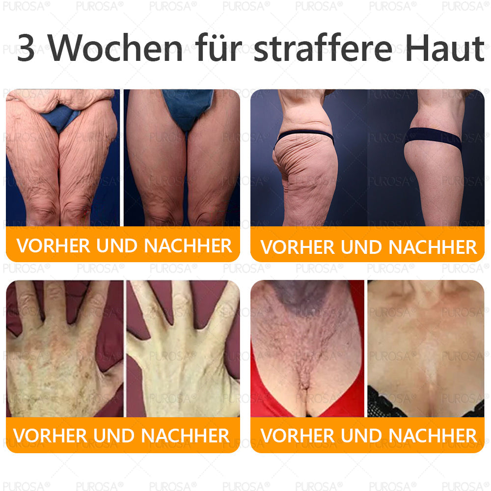 ❤️𝗣𝗨𝗥𝗢𝗦𝗔® 8-in-1 Bienengift & Talg Hautcreme – Jetzt -80% · Sichtbare Wirkung in 7 Tagen · Nur heute letzter Tag!